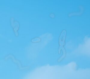 하늘을 배경으로 한 비문증의 예술적 재현 1