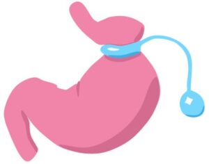 위 밴드 아이콘