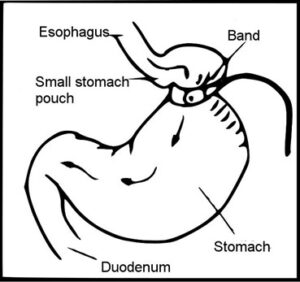 위 밴드 작동 방법 이미지