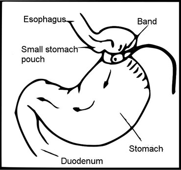 위 밴드 작동 방법 이미지